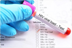 Viral load. Everything you need to know
