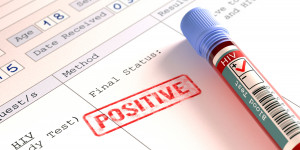 Telling others your HIV-positive status