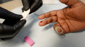 False positive results on HIV tests